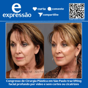 Leia mais sobre o artigo Congresso de Cirurgia Plástica em São Paulo traz lifting facial profundo por vídeo e sem cortes ou cicatrizes